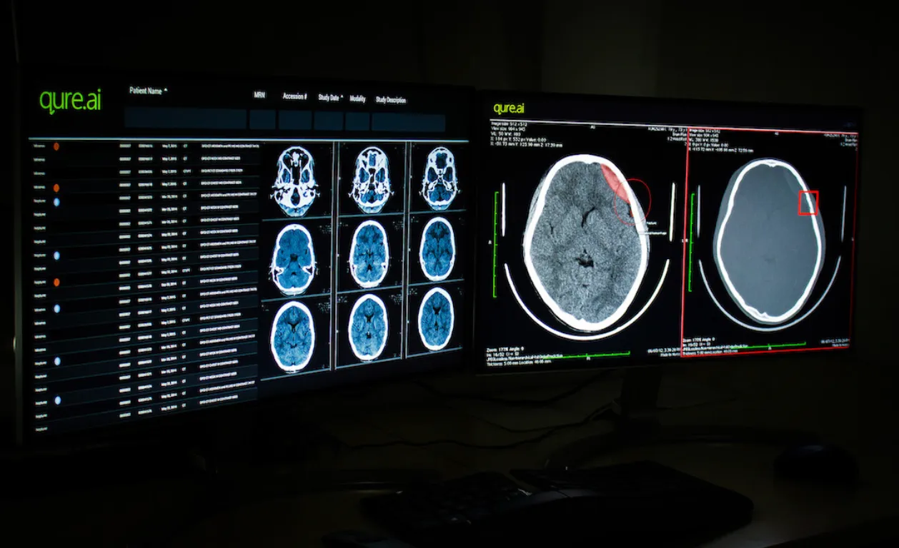 Qure.ai Is Helping Doctors Across the World — One Scan at a Time